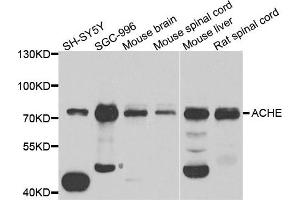 Western blot analysis of extract of various cells, using ACHE antibody. (Acetylcholinesterase antibody)