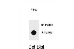 Dot blot analysis of Phospho-PTEN- Antibody Phospho-specific Pab (ABIN6241047 and ABIN6578933) on nitrocellulose membrane. (PTEN antibody  (pSer229))