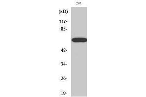 Western Blotting (WB) image for anti-Paxillin (PXN) (Thr507) antibody (ABIN3176785) (Paxillin antibody  (Thr507))