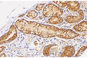 Immunohistochemistry of paraffin-embedded Human duodenum using CD38 Polycloanl Antibody at dilution of 1:200 (CD38 antibody)