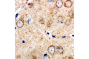 Immunohistochemical analysis of GAS3 staining in human brain formalin fixed paraffin embedded tissue section. (PMP22 antibody  (C-Term))