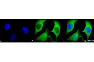 Immunocytochemistry/Immunofluorescence analysis using Mouse Anti-Ubiquitin Monoclonal Antibody, Clone 5B9-B3 . (Ubiquitin antibody  (Atto 594))