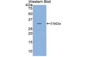 Western blot analysis of the recombinant protein. (Superoxide dismutase copper chaperone antibody  (AA 17-270))