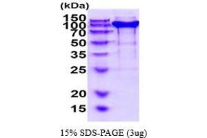 SDS-PAGE (SDS) image for Neuropilin 1 (NRP1) (AA 22-856) protein (His tag) (ABIN6387813) (Neuropilin 1 Protein (NRP1) (AA 22-856) (His tag))