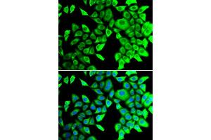 Immunofluorescence analysis of A549 cells using THADA antibody. (THADA antibody)
