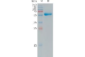 Human CXADR Protein, hFc Tag on SDS-PAGE under reducing condition. (Coxsackie Adenovirus Receptor Protein (AA 20-237) (Fc Tag))