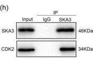 SKA3 inhibited the interaction between CDK2 and p53. (SKA3 antibody  (AA 201-300))