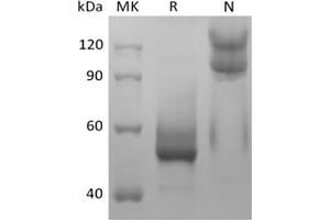 Western Blotting (WB) image for Tumor Necrosis Factor (Ligand) Superfamily, Member 13b (TNFSF13B) protein (ABIN7320913) (BAFF Protein)