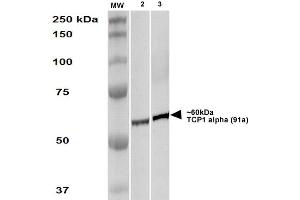 Western Blot analysis of Human A431 and HEK293 cell lysates showing detection of TCP1 alpha protein using Rat Anti-TCP1 alpha Monoclonal Antibody, Clone 91a . (TCP1 alpha/CCTA antibody  (C-Term) (Atto 390))