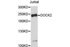 Western blot analysis of extracts of Jurkat cells, using DOCK2 antibody (ABIN4903501). (DOCK2 antibody)