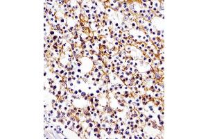 Immunohistochemistry (Paraffin-embedded Sections) (IHC (p)) image for anti-Integrin alpha M (ITGAM) (AA 253-282), (N-Term) antibody (ABIN654625)