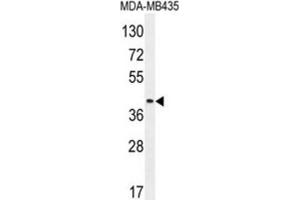 Western Blotting (WB) image for anti-Leukocyte Immunoglobulin-Like Receptor, Subfamily A (With TM Domain), Member 5 (LILRA5) antibody (ABIN2996291) (LILRA5 antibody)