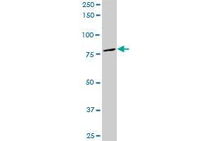 LOXL3 polyclonal antibody (A01), Lot # TBB0060623QCS1. (LOXL3 antibody  (AA 171-270))