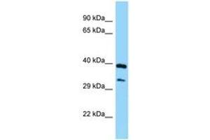 Image no. 1 for anti-Sphingosine Kinase 1 (SPHK1) (AA 176-225) antibody (ABIN6748074) (SPHK1 antibody  (AA 176-225))