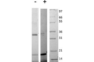 SDS-PAGE of Rat Interleukin-17E (IL-25) Recombinant Protein SDS-PAGE of Rat Interleukin-17E (IL-25) Recombinant Protein. (IL-25 Protein)