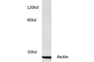 Image no. 2 for anti-Actin (pan) antibody (ABIN265298) (Actin antibody  (pan))