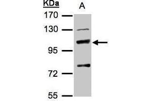 MANBA antibody