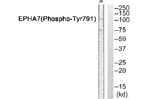 Western blot analysis of extracts from JurKat cells, using EPHA7 (Phospho-Tyr791) antibody. (EPH Receptor A7 antibody  (pTyr791))