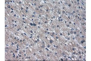 Immunohistochemical staining of paraffin-embedded endometrium tissue using anti-CYP2E1 mouse monoclonal antibody. (CYP2E1 antibody)