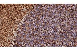 Normal brain: immunohistochemical staining for Glial Fibrillary Acidic Protein. (GFAP antibody)