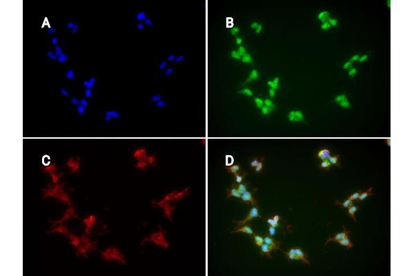 FcRn antibody