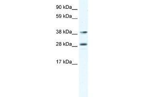 MEF2B antibody (20R-1125) used at 0. (MEF2B antibody  (C-Term))