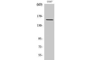 Western Blotting (WB) image for anti-Polymerase (RNA) III (DNA Directed) Polypeptide A, 155kDa (POLR3A) (N-Term) antibody (ABIN3186520) (POLR3A antibody  (N-Term))