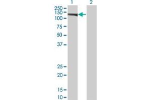 Western Blot analysis of EIF4ENIF1 expression in transfected 293T cell line by EIF4ENIF1 monoclonal antibody (M01), clone 2C4. (EIF4ENIF1 antibody  (AA 886-985))