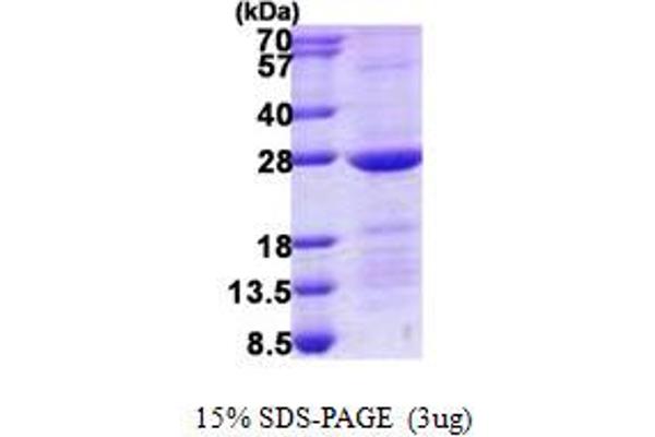 RAB10 Protein (His tag)