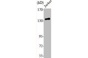 Western Blot analysis of Jurkat cells using N-cadherin Polyclonal Antibody (N-Cadherin antibody  (C-Term))