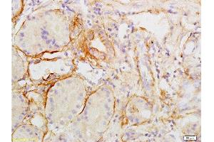 Immunohistochemistry (Paraffin-embedded Sections) (IHC (p)) image for anti-Collagen, Type II (COL2) (AA 1201-1300) antibody (ABIN672171)