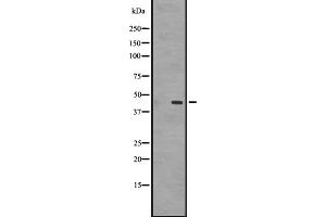 Western blot analysis of GPR87/GPR95 expression in A431 whole cell lysate ,The lane on the left is treated with the antigen-specific peptide. (GPR87 antibody  (C-Term))