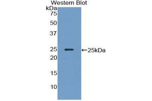 Western Blotting (WB) image for anti-Neurofilament Triplet M Protein (NEFM) (AA 105-287) antibody (ABIN1859976) (NEFM antibody  (AA 105-287))