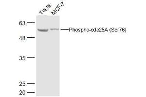 Lane 1: Mouse Testis lysates Lane 2: Human MCF-7 lysates probed with Phospho-cdc25A (Ser76) Polyclonal Antibody, Unconjugated  at 1:500 dilution and 4˚C overnight incubation. (CDC25A antibody  (pSer76))