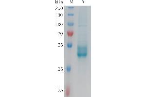 Human IL25 Protein, hFc Tag on SDS-PAGE under reducing condition. (IL-25 Protein (AA 33-177) (Fc Tag))