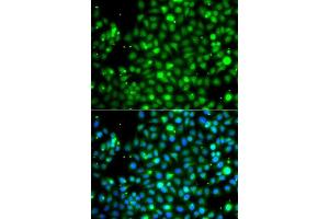 Immunofluorescence analysis of A549 cells using NME2 antibody. (NME2 antibody  (AA 1-152))