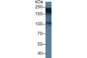 Detection of TNC in Rat Placenta lysate using Polyclonal Antibody to Tenascin C (TNC) (TNC antibody  (AA 513-621))