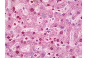 Anti-CIDEA / CIDE-A antibody IHC staining of human liver. (CIDEA antibody  (AA 181-209))