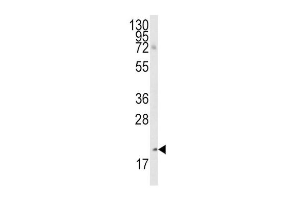 BMF antibody  (AA 115-150)