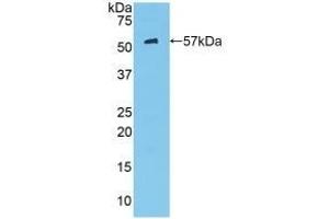 Detection of Recombinant HK2, Mouse using Polyclonal Antibody to Hexokinase 2 (HK2) (Hexokinase 2 antibody  (AA 605-868))