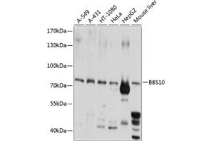 Western blot analysis of extracts of various cell lines, using BBS10 antibody  at 1:1000 dilution. (BBS10 antibody  (AA 474-723))