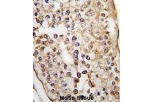 Immunohistochemistry (IHC) image for anti-Pumilio Homolog 2 (Drosophila) (PUM2) antibody (ABIN3003295) (PUM2 antibody)