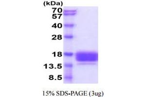 SDS-PAGE (SDS) image for Carcinoembryonic Antigen-Related Cell Adhesion Molecule 3 (CEACAM3) (AA 35-155) protein (His tag) (ABIN5854924) (CEACAM3 Protein (AA 35-155) (His tag))