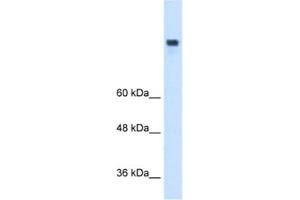 Western Blotting (WB) image for anti-Microsomal Triglyceride Transfer Protein (MTTP) antibody (ABIN2462724) (MTTP antibody)