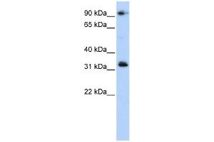 CCDC69 antibody used at 1 ug/ml to detect target protein. (CCDC69 antibody  (Middle Region))