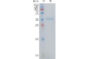Human Protein, hFc Tag on SDS-PAGE under reducing condition. (CCL3 Protein (AA 27-92) (Fc Tag))