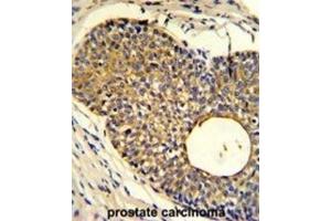 Immunohistochemistry (IHC) image for anti-Phosphate Transporter PHO1 antibody (ABIN2919906) (Phosphate Transporter PHO1 antibody)