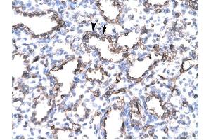 Endoglin antibody was used for immunohistochemistry at a concentration of 4-8 ug/ml to stain Alveolar cells (lndicated with Arrows) in Human Lung. (Endoglin antibody)