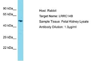 Host: Rabbit Target Name: LRRC14B Sample Type: Fetal Kidney lysates Antibody Dilution: 1. (LRRC14B antibody  (C-Term))
