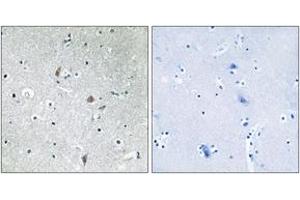 Immunohistochemistry (IHC) image for anti-Mechanistic Target of Rapamycin (serine/threonine Kinase) (mTOR) (pSer2448) antibody (ABIN2888475) (MTOR antibody  (pSer2448))
